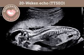 seo echo